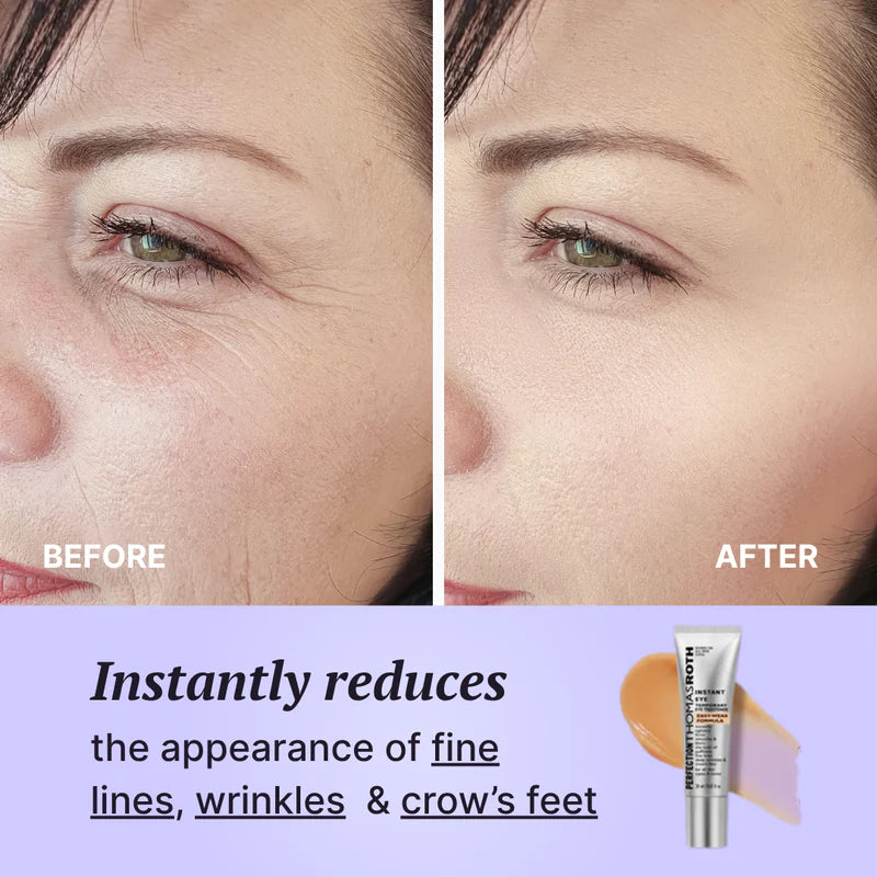 FirmX Easy-Wear Instant Eye Tightener